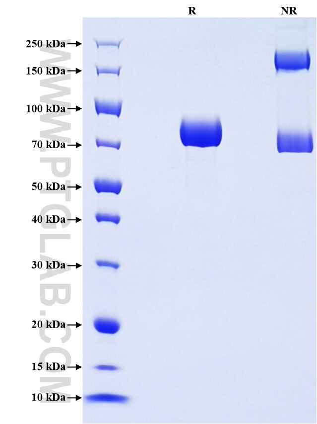 Purity of Recombinant Mouse IL-3RB was determined by SDS-PAGE. The protein was resolved in an SDS-PAGE in reducing (R) and non-reducing (NR) conditions and stained using Coomassie blue. Purity of Recombinant Mouse IL-3RB was determined by SDS-PAGE. The protein was resolved in an SDS-PAGE in reducing (R) and non-reducing (NR) conditions and stained using Coomassie blue.