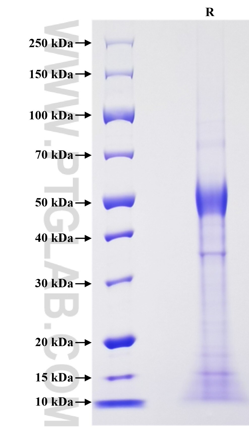 Purity of Recombinant Mouse IL-15 was determined by SDS-PAGE. The protein was resolved in an SDS-PAGE in reducing (R) conditions and stained using Coomassie blue.