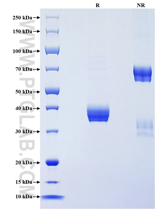 Purity of Recombinant Human SPINT3 was determined by SDS-PAGE. The protein was resolved in an SDS-PAGE in reducing (R) and non-reducing (NR) conditions and stained using Coomassie blue.