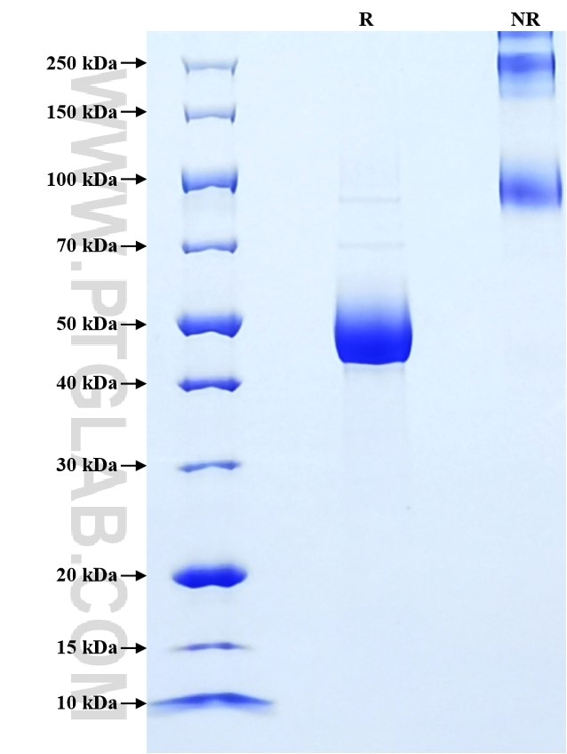 Purity of Recombinant Human IL-31 was determined by SDS-PAGE. The protein was resolved in an SDS-PAGE in reducing (R) and non-reducing (NR) conditions and stained using Coomassie blue.