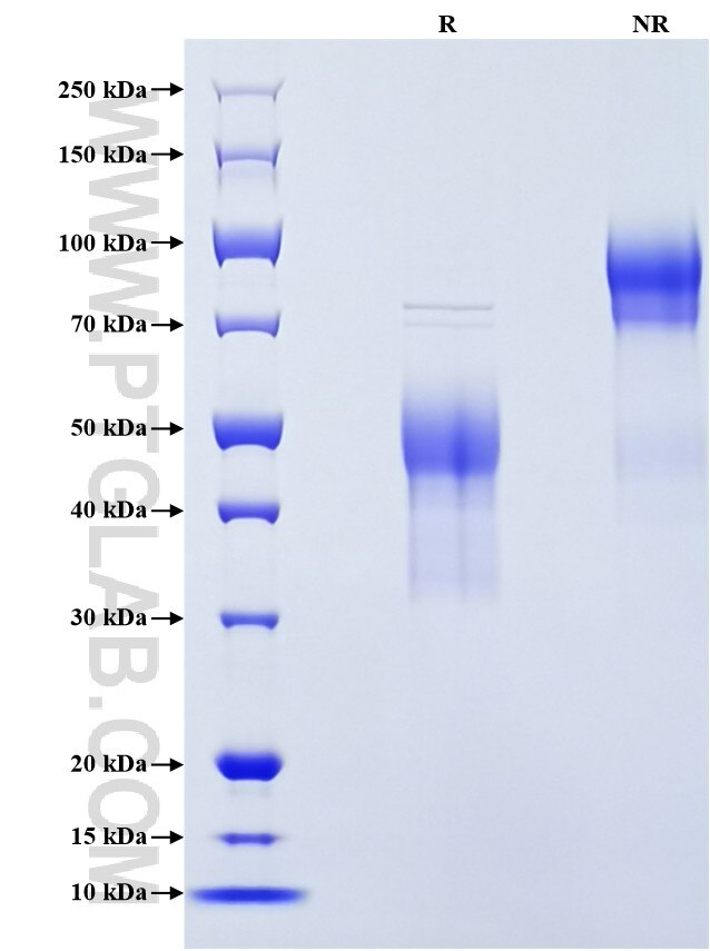 Purity of Recombinant Human ER was determined by SDS-PAGE. The protein was resolved in an SDS-PAGE in reducing (R) and non-reducing (NR) conditions and stained using Coomassie blue.