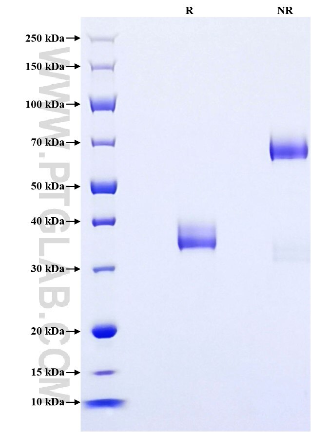 Purity of Recombinant Mouse CXCL2 was determined by SDS-PAGE. The protein was resolved in an SDS-PAGE in reducing (R) and non-reducing (NR) conditions and stained using Coomassie blue.