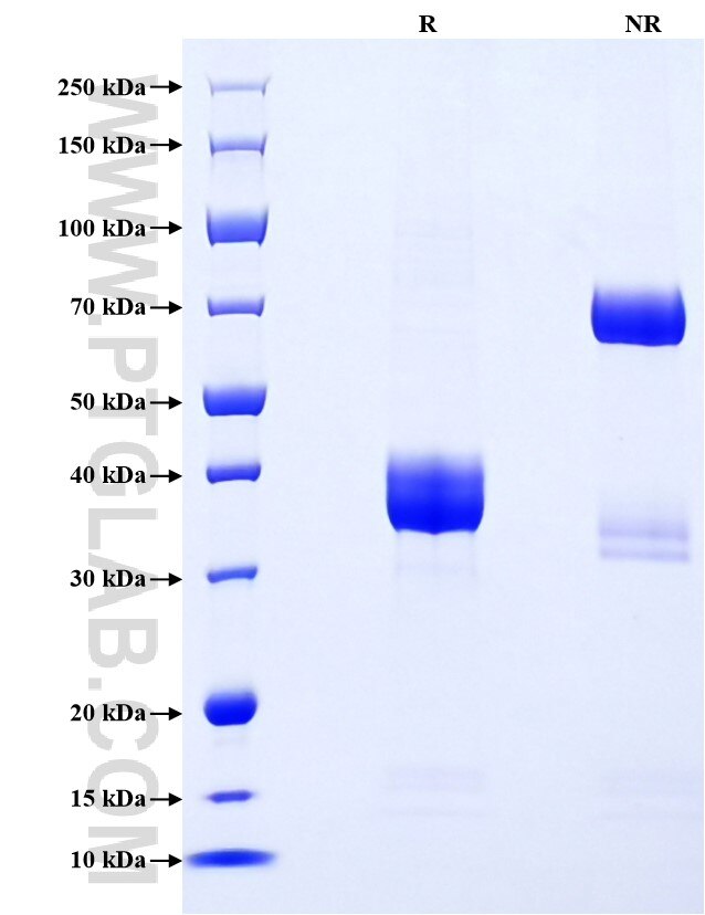Purity of Recombinant Mouse CCL22 was determined by SDS-PAGE. The protein was resolved in an SDS-PAGE in reducing (R) and non-reducing (NR) conditions and stained using Coomassie blue. Purity of Recombinant Mouse CCL22 was determined by SDS-PAGE. The protein was resolved in an SDS-PAGE in reducing (R) and non-reducing (NR) conditions and stained using Coomassie blue.