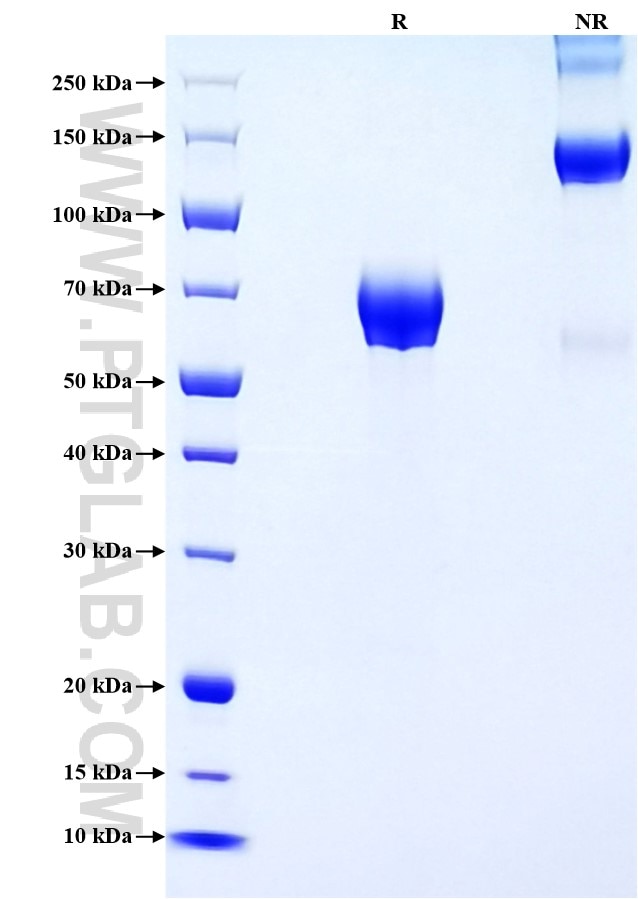 Purity of Recombinant Human BTN2A1 was determined by SDS-PAGE. The protein was resolved in an SDS-PAGE in reducing (R) and non-reducing (NR) conditions and stained using Coomassie blue. Purity of Recombinant Human BTN2A1 was determined by SDS-PAGE. The protein was resolved in an SDS-PAGE in reducing (R) and non-reducing (NR) conditions and stained using Coomassie blue.