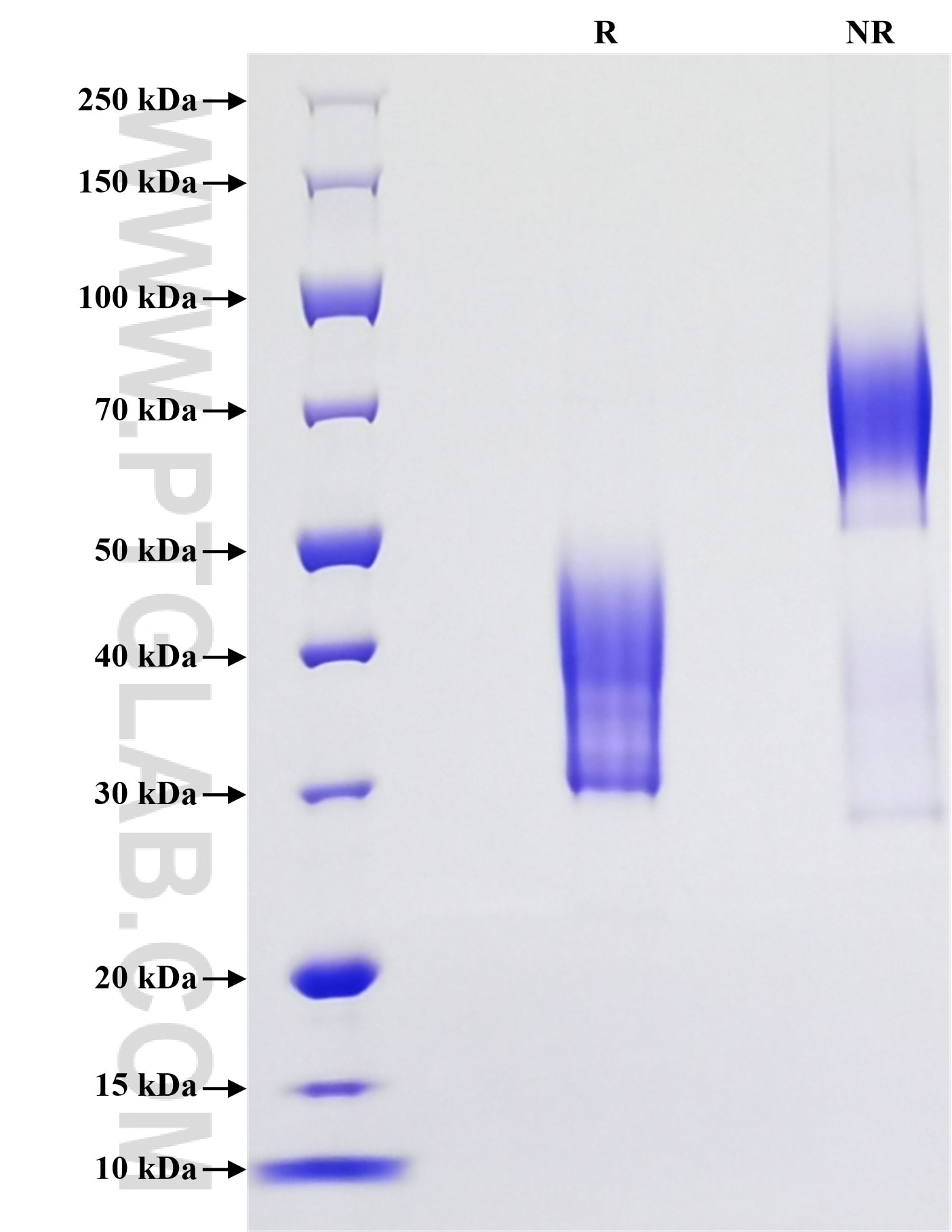Purity of Recombinant Human CXCR3 was determined by SDS-PAGE. The protein was resolved in an SDS-PAGE in reducing (R) and non-reducing (NR) conditions and stained using Coomassie blue.