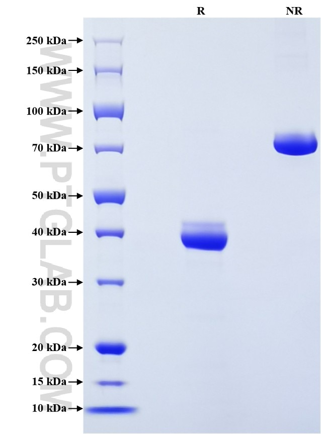 Purity of Recombinant Human Beta-2-Microglobulin was determined by SDS-PAGE. The protein was resolved in an SDS-PAGE in reducing (R) and non-reducing (NR) conditions and stained using Coomassie blue.