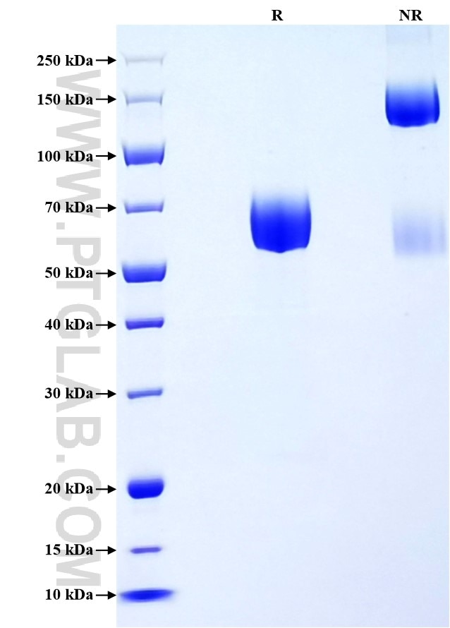Purity of Recombinant Human CD244 was determined by SDS-PAGE. The protein was resolved in an SDS-PAGE in reducing (R) and non-reducing (NR) conditions and stained using Coomassie blue. Purity of Recombinant Human CD244 was determined by SDS-PAGE. The protein was resolved in an SDS-PAGE in reducing (R) and non-reducing (NR) conditions and stained using Coomassie blue.