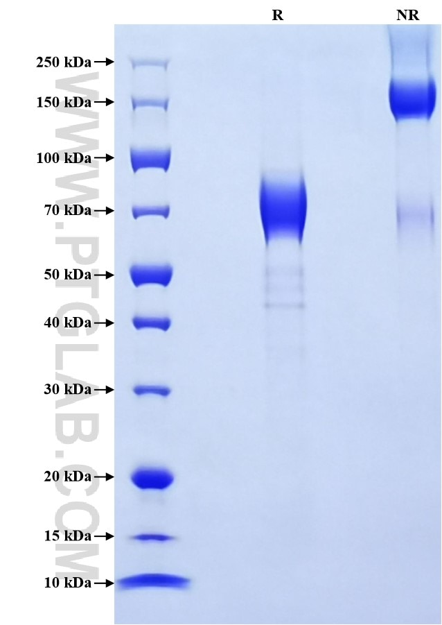 Purity of Recombinant Human IL-10RA was determined by SDS-PAGE. The protein was resolved in an SDS-PAGE in reducing (R) and non-reducing (NR) conditions and stained using Coomassie blue.