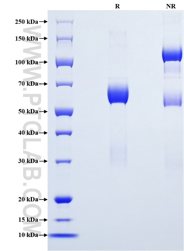 Purity of Recombinant Human CD207 was determined by SDS-PAGE. The protein was resolved in an SDS-PAGE in reducing (R) and non-reducing (NR) conditions and stained using Coomassie blue. Purity of Recombinant Human CD207 was determined by SDS-PAGE. The protein was resolved in an SDS-PAGE in reducing (R) and non-reducing (NR) conditions and stained using Coomassie blue.
