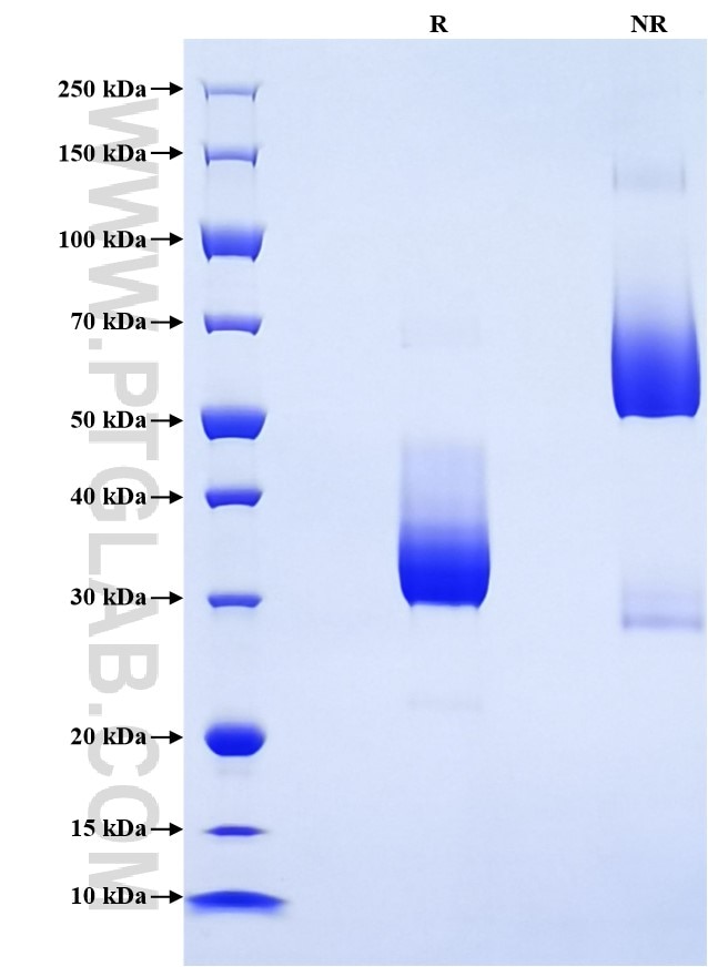 Purity of Recombinant Human CCR6 was determined by SDS-PAGE. The protein was resolved in an SDS-PAGE in reducing (R) and non-reducing (NR) conditions and stained using Coomassie blue. Purity of Recombinant Human CCR6 was determined by SDS-PAGE. The protein was resolved in an SDS-PAGE in reducing (R) and non-reducing (NR) conditions and stained using Coomassie blue.