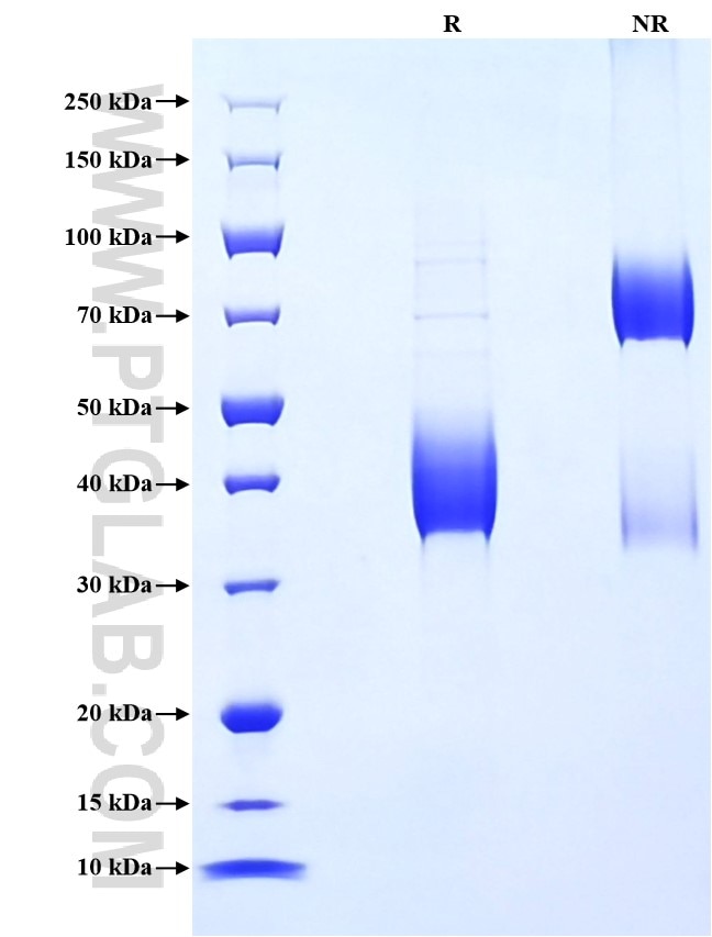 Purity of Recombinant Human ABCB1 was determined by SDS-PAGE. The protein was resolved in an SDS-PAGE in reducing (R) and non-reducing (NR) conditions and stained using Coomassie blue.