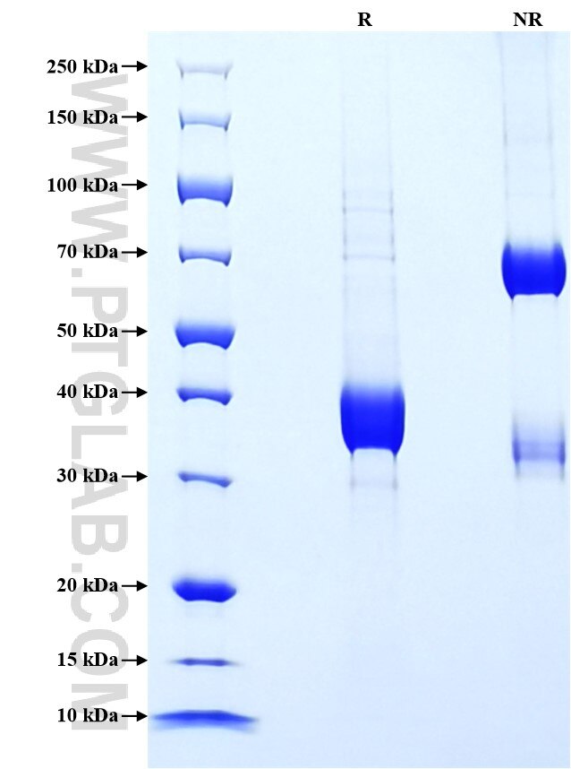 Purity of Recombinant Human CCL20 was determined by SDS-PAGE. The protein was resolved in an SDS-PAGE in reducing (R) and non-reducing (NR) conditions and stained using Coomassie blue.