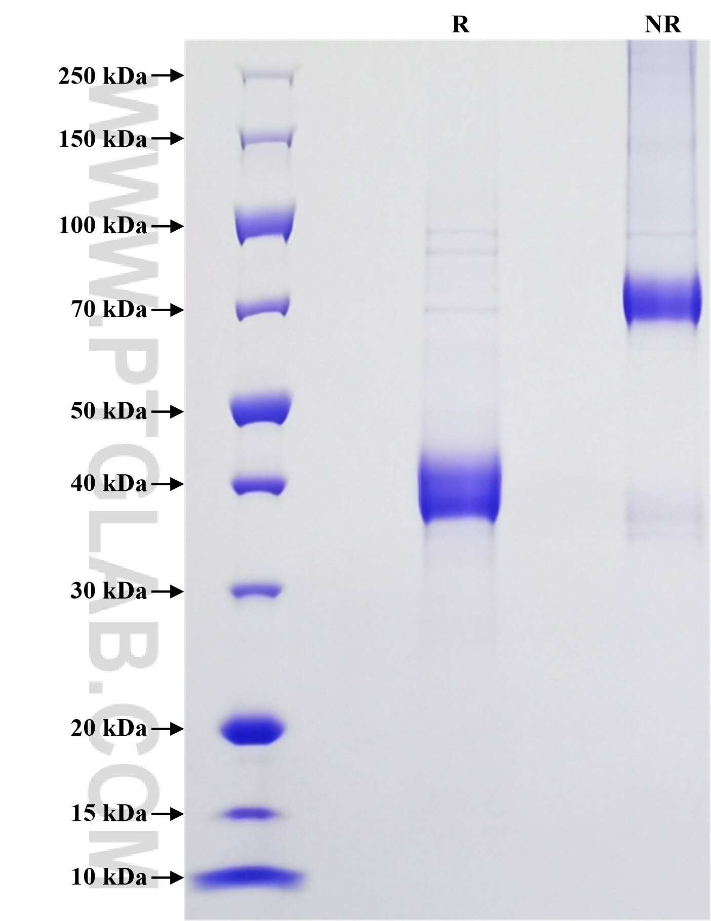 Purity of Recombinant Mouse Ccl11 was determined by SDS-PAGE. The protein was resolved in an SDS-PAGE in reducing (R) and non-reducing (NR) conditions and stained using Coomassie blue.