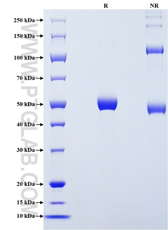 Purity of Recombinant Rat Ferritin light chain 1 was determined by SDS-PAGE. The protein was resolved in an SDS-PAGE in reducing (R) and non-reducing (NR) conditions and stained using Coomassie blue. Purity of Recombinant Rat Ferritin light chain 1 was determined by SDS-PAGE. The protein was resolved in an SDS-PAGE in reducing (R) and non-reducing (NR) conditions and stained using Coomassie blue.