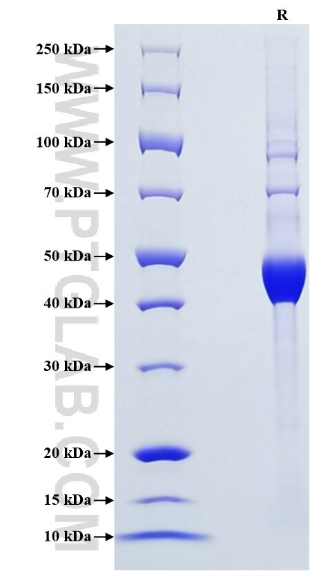 Purity of Recombinant Human EDDM3B was determined by SDS-PAGE. The protein was resolved in an SDS-PAGE in reducing (R) conditions and stained using Coomassie blue.