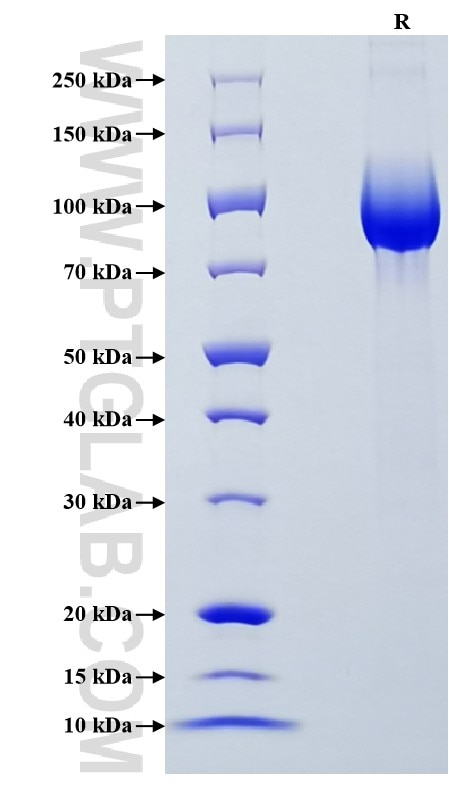 Purity of Recombinant Human GP2 was determined by SDS-PAGE. The protein was resolved in an SDS-PAGE in reducing (R) conditions and stained using Coomassie blue.