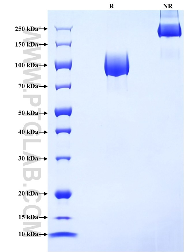 Purity of Recombinant Human GP2 was determined by SDS-PAGE. The protein was resolved in an SDS-PAGE in reducing (R) and non-reducing (NR) conditions and stained using Coomassie blue.
