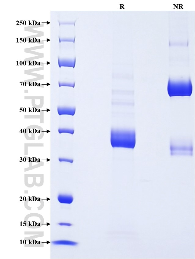 Purity of Recombinant Human CCL27 was determined by SDS-PAGE. The protein was resolved in an SDS-PAGE in reducing (R) and non-reducing (NR) conditions and stained using Coomassie blue.