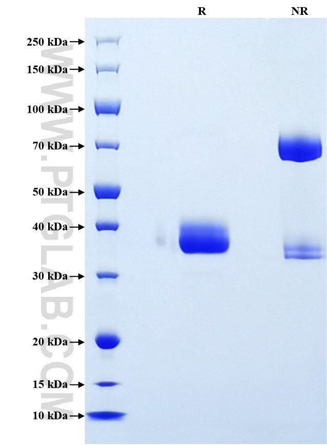 Purity of Recombinant Mouse ACBP was determined by SDS-PAGE. The protein was resolved in an SDS-PAGE in reducing (R) and non-reducing (NR) conditions and stained using Coomassie blue.