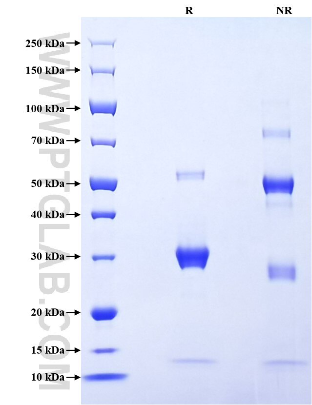 Purity of Recombinant Human KLK14 was determined by SDS-PAGE. The protein was resolved in an SDS-PAGE in reducing (R) and non-reducing (NR) conditions and stained using Coomassie blue. Purity of Recombinant Human KLK14 was determined by SDS-PAGE. The protein was resolved in an SDS-PAGE in reducing (R) and non-reducing (NR) conditions and stained using Coomassie blue.