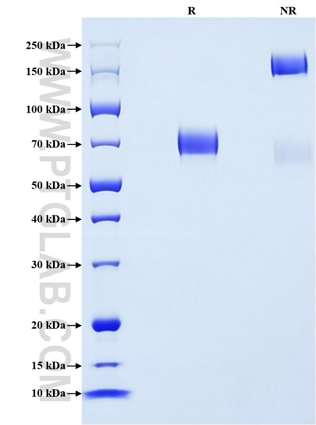 Purity of Recombinant Mouse OLR1 was determined by SDS-PAGE. The protein was resolved in an SDS-PAGE in reducing (R) and non-reducing (NR) conditions and stained using Coomassie blue.