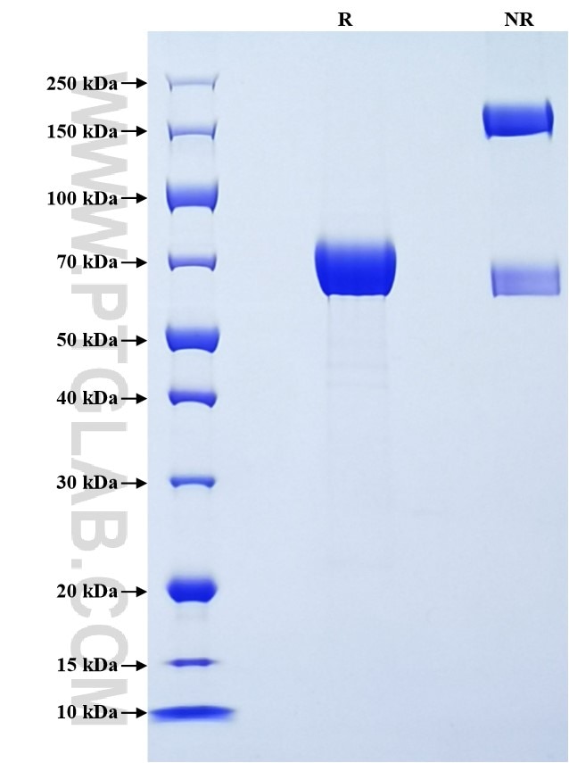 Purity of Recombinant Mouse Lumican was determined by SDS-PAGE. The protein was resolved in an SDS-PAGE in reducing (R) and non-reducing (NR) conditions and stained using Coomassie blue.