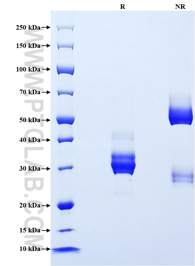 Purity of Recombinant Human CXCL10 was determined by SDS-PAGE. The protein was resolved in an SDS-PAGE in reducing (R) and non-reducing (NR) conditions and stained using Coomassie blue.