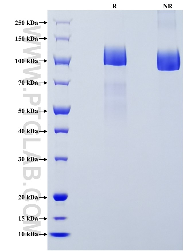 Purity of Recombinant Human FLT4 was determined by SDS-PAGE. The protein was resolved in an SDS-PAGE in reducing (R) and non-reducing (NR) conditions and stained using Coomassie blue. Purity of Recombinant Human FLT4 was determined by SDS-PAGE. The protein was resolved in an SDS-PAGE in reducing (R) and non-reducing (NR) conditions and stained using Coomassie blue.