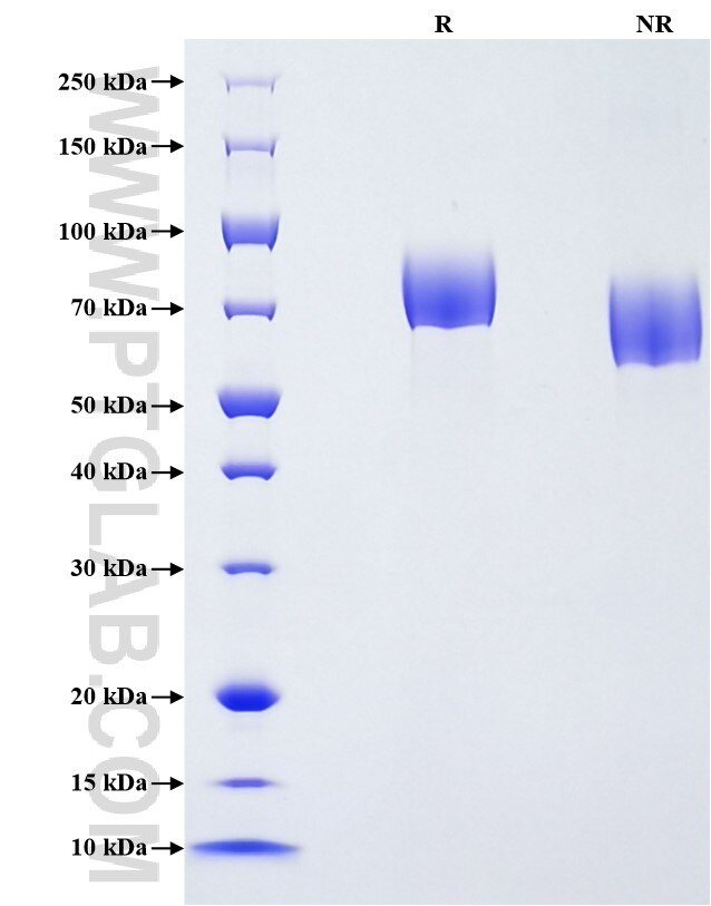 Purity of Recombinant Human PDGFR alpha was determined by SDS-PAGE. The protein was resolved in an SDS-PAGE in reducing (R) and non-reducing (NR) conditions and stained using Coomassie blue. Purity of Recombinant Human PDGFR alpha was determined by SDS-PAGE. The protein was resolved in an SDS-PAGE in reducing (R) and non-reducing (NR) conditions and stained using Coomassie blue.