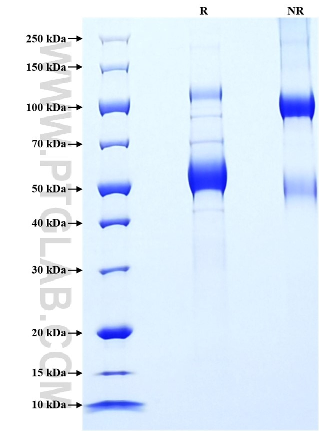 Purity of Recombinant Human TNFSF11 was determined by SDS-PAGE. The protein was resolved in an SDS-PAGE in reducing (R) and non-reducing (NR) conditions and stained using Coomassie blue. Purity of Recombinant Human TNFSF11 was determined by SDS-PAGE. The protein was resolved in an SDS-PAGE in reducing (R) and non-reducing (NR) conditions and stained using Coomassie blue.