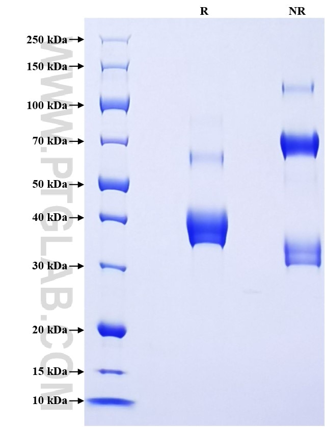 Purity of Recombinant Human CXCL1 was determined by SDS-PAGE. The protein was resolved in an SDS-PAGE in reducing (R) and non-reducing (NR) conditions and stained using Coomassie blue. Purity of Recombinant Human CXCL1 was determined by SDS-PAGE. The protein was resolved in an SDS-PAGE in reducing (R) and non-reducing (NR) conditions and stained using Coomassie blue.