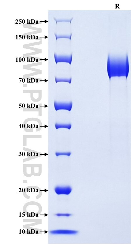 Purity of Recombinant Human CD204 was determined by SDS-PAGE. The protein was resolved in an SDS-PAGE in reducing (R) conditions and stained using Coomassie blue.