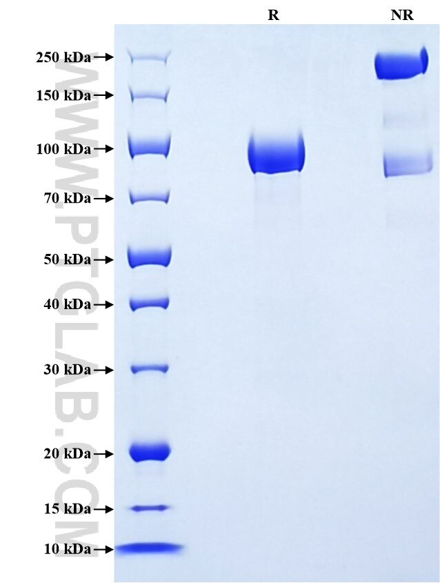 Purity of Recombinant Human BCAM was determined by SDS-PAGE. The protein was resolved in an SDS-PAGE in reducing (R) and non-reducing (NR) conditions and stained using Coomassie blue.