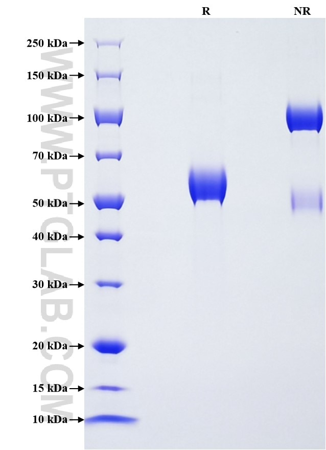Purity of Recombinant Human CLEC4C was determined by SDS-PAGE. The protein was resolved in an SDS-PAGE in reducing (R) and non-reducing (NR) conditions and stained using Coomassie blue. Purity of Recombinant Human CLEC4C was determined by SDS-PAGE. The protein was resolved in an SDS-PAGE in reducing (R) and non-reducing (NR) conditions and stained using Coomassie blue.