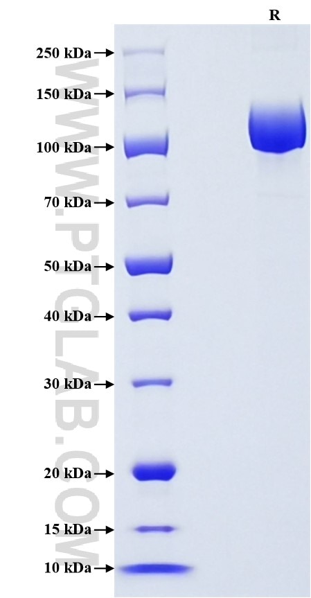 Purity of Recombinant Human Neprilysin was determined by SDS-PAGE. The protein was resolved in an SDS-PAGE in reducing (R) conditions and stained using Coomassie blue.
