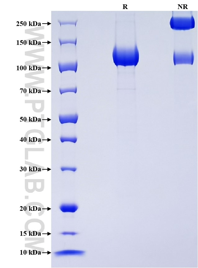 Purity of Recombinant Human CDCP1 was determined by SDS-PAGE. The protein was resolved in an SDS-PAGE in reducing (R) and non-reducing (NR) conditions and stained using Coomassie blue. Purity of Recombinant Human CDCP1 was determined by SDS-PAGE. The protein was resolved in an SDS-PAGE in reducing (R) and non-reducing (NR) conditions and stained using Coomassie blue.