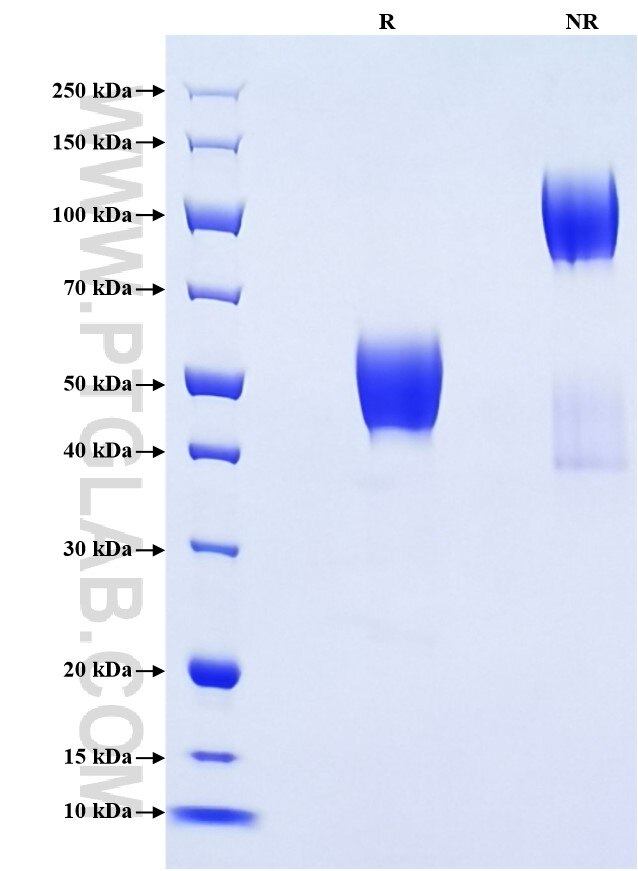 Purity of Recombinant Mouse LAIR1 was determined by SDS-PAGE. The protein was resolved in an SDS-PAGE in reducing (R) and non-reducing (NR) conditions and stained using Coomassie blue. Purity of Recombinant Mouse LAIR1 was determined by SDS-PAGE. The protein was resolved in an SDS-PAGE in reducing (R) and non-reducing (NR) conditions and stained using Coomassie blue.