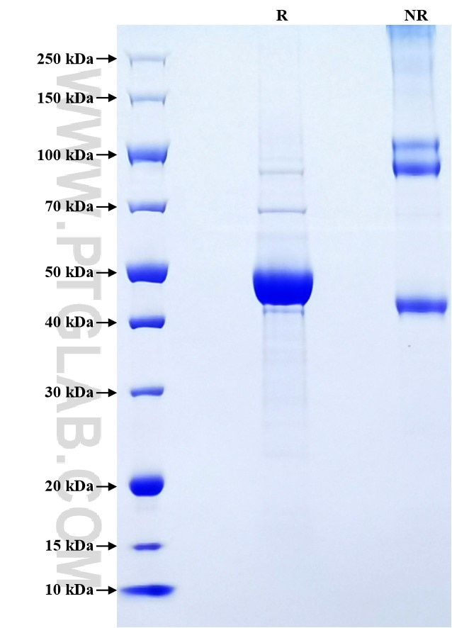 Purity of Recombinant Rat IL-1 beta was determined by SDS-PAGE. The protein was resolved in an SDS-PAGE in reducing (R) and non-reducing (NR) conditions and stained using Coomassie blue.