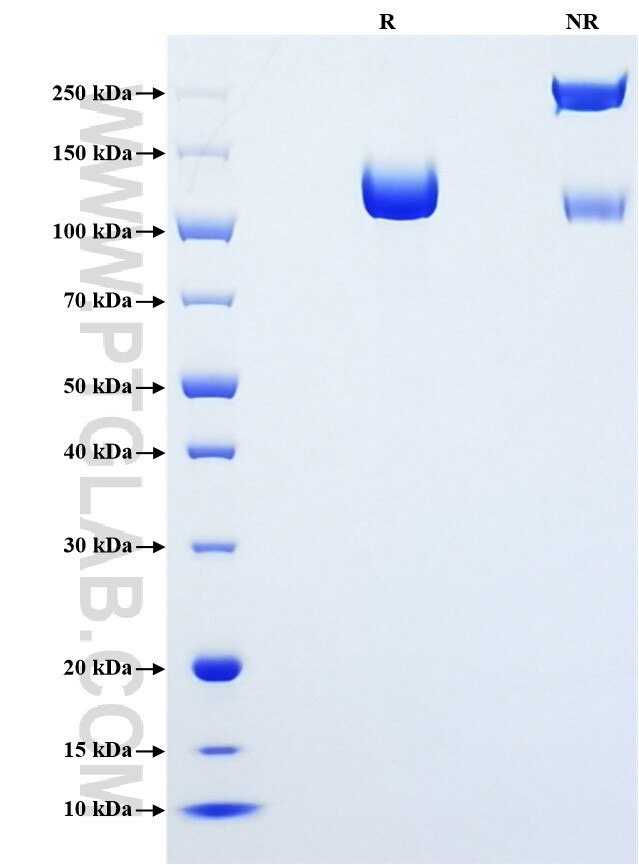 Purity of Recombinant Mouse CD22 was determined by SDS-PAGE. The protein was resolved in an SDS-PAGE in reducing (R) and non-reducing (NR) conditions and stained using Coomassie blue.