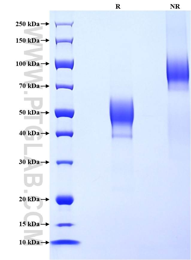 Purity of Recombinant Human IGLV3-21 was determined by SDS-PAGE. The protein was resolved in an SDS-PAGE in reducing (R) and non-reducing (NR) conditions and stained using Coomassie blue.