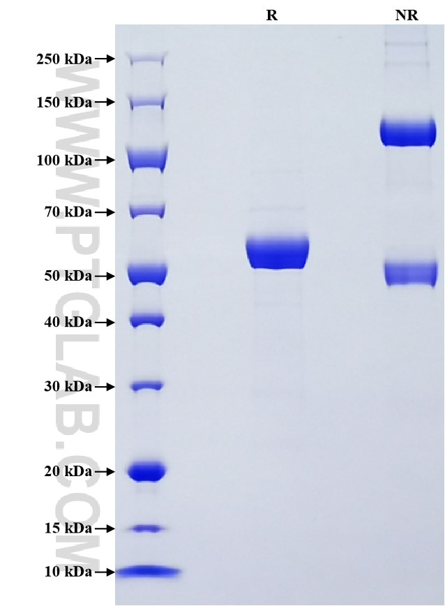 Purity of Recombinant Human EPOR was determined by SDS-PAGE. The protein was resolved in an SDS-PAGE in reducing (R) and non-reducing (NR) conditions and stained using Coomassie blue. Purity of Recombinant Human EPOR was determined by SDS-PAGE. The protein was resolved in an SDS-PAGE in reducing (R) and non-reducing (NR) conditions and stained using Coomassie blue.