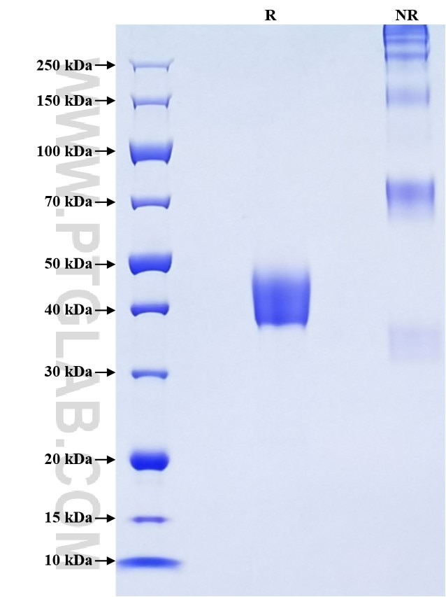 Purity of Recombinant Mouse Ly6g was determined by SDS-PAGE. The protein was resolved in an SDS-PAGE in reducing (R) and non-reducing (NR) conditions and stained using Coomassie blue.