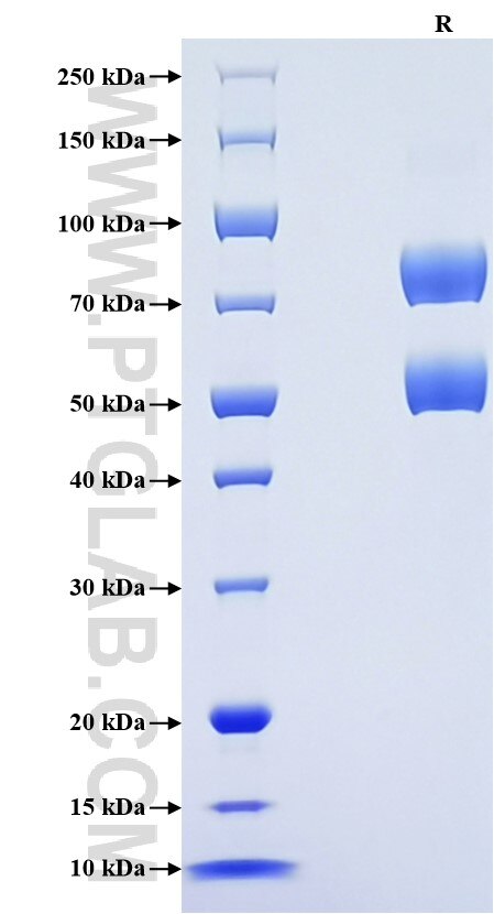 Purity of Recombinant Human SUSD2 was determined by SDS-PAGE. The protein was resolved in an SDS-PAGE in reducing (R) condition and stained using Coomassie blue.