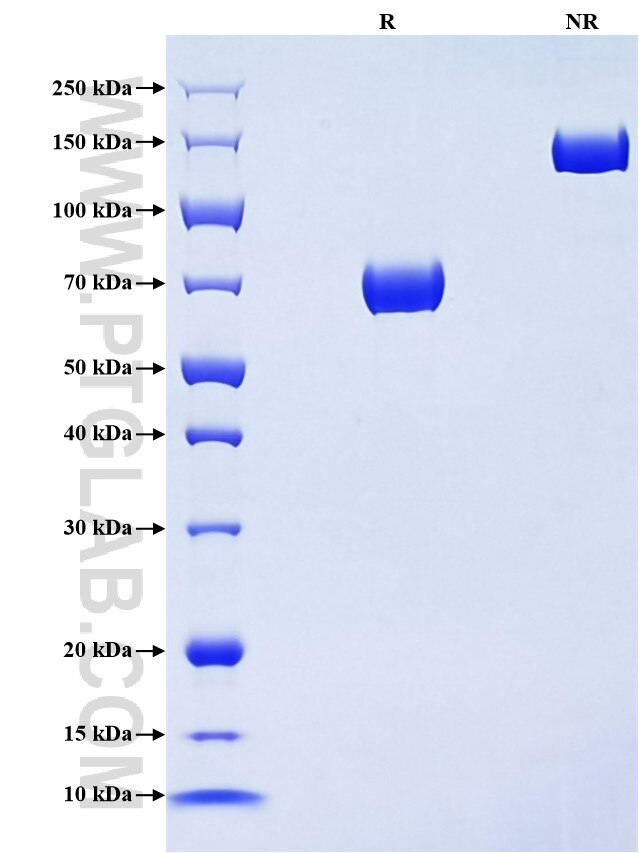Purity of Recombinant Human Siglec-8 was determined by SDS-PAGE. The protein was resolved in an SDS-PAGE in reducing (R) and non-reducing (NR) conditions and stained using Coomassie blue. Purity of Recombinant Human Siglec-8 was determined by SDS-PAGE. The protein was resolved in an SDS-PAGE in reducing (R) and non-reducing (NR) conditions and stained using Coomassie blue.