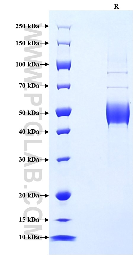 Purity of Recombinant Human NKG2C was determined by SDS-PAGE. The protein was resolved in an SDS-PAGE in reducing (R) conditions and stained using Coomassie blue. Purity of Recombinant Human NKG2C was determined by SDS-PAGE. The protein was resolved in an SDS-PAGE in reducing (R) conditions and stained using Coomassie blue.