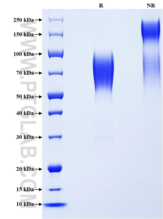 Purity of Recombinant Mouse CD164 was determined by SDS-PAGE. The protein was resolved in an SDS-PAGE in reducing (R) and non-reducing (NR) conditions and stained using Coomassie blue. Purity of Recombinant Mouse CD164 was determined by SDS-PAGE. The protein was resolved in an SDS-PAGE in reducing (R) and non-reducing (NR) conditions and stained using Coomassie blue.