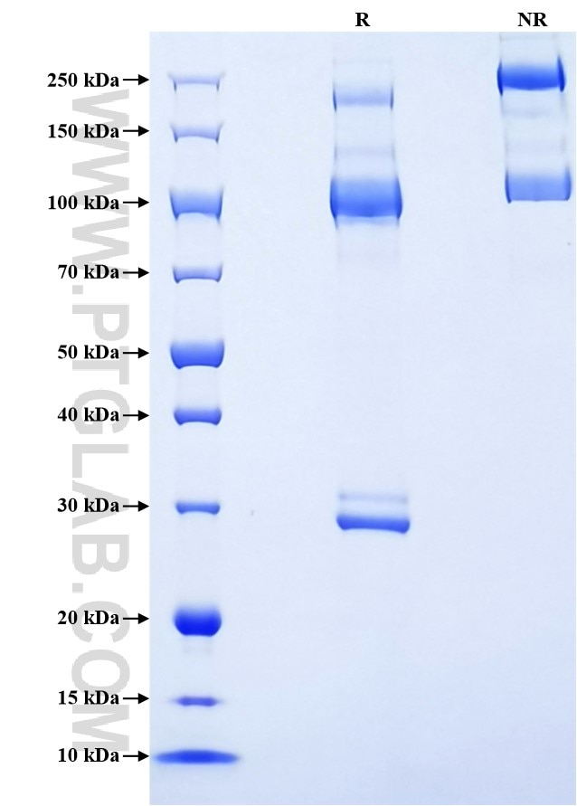 Purity of Recombinant Mouse MST1R was determined by SDS-PAGE. The protein was resolved in an SDS-PAGE in reducing (R) and non-reducing (NR) conditions and stained using Coomassie blue.