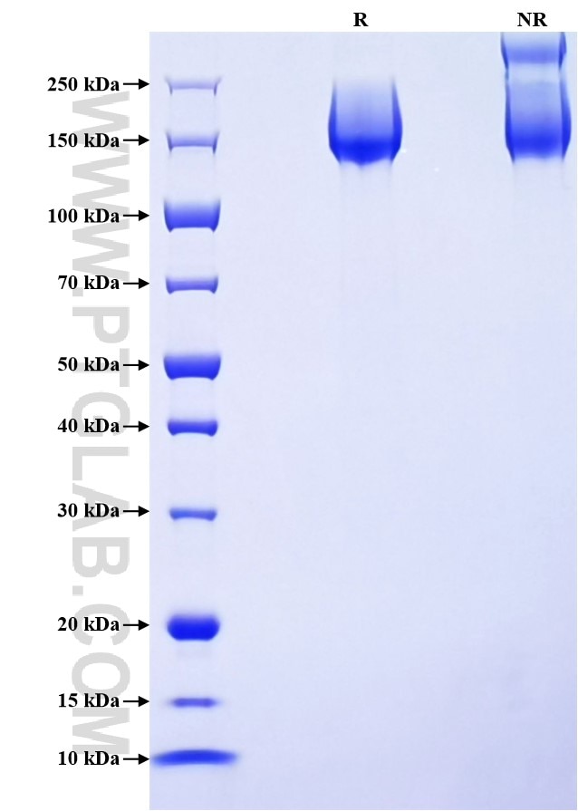 Purity of Recombinant Mouse PTPRJ/CD148 was determined by SDS-PAGE. The protein was resolved in an SDS-PAGE in reducing (R) and non-reducing (NR) conditions and stained using Coomassie blue. Purity of Recombinant Mouse PTPRJ/CD148 was determined by SDS-PAGE. The protein was resolved in an SDS-PAGE in reducing (R) and non-reducing (NR) conditions and stained using Coomassie blue.