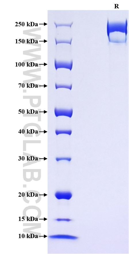 Purity of Recombinant Mouse LY75 was determined by SDS-PAGE. The protein was resolved in an SDS-PAGE in reducing (R) conditions and stained using Coomassie blue. Purity of Recombinant Mouse LY75 was determined by SDS-PAGE. The protein was resolved in an SDS-PAGE in reducing (R) conditions and stained using Coomassie blue.