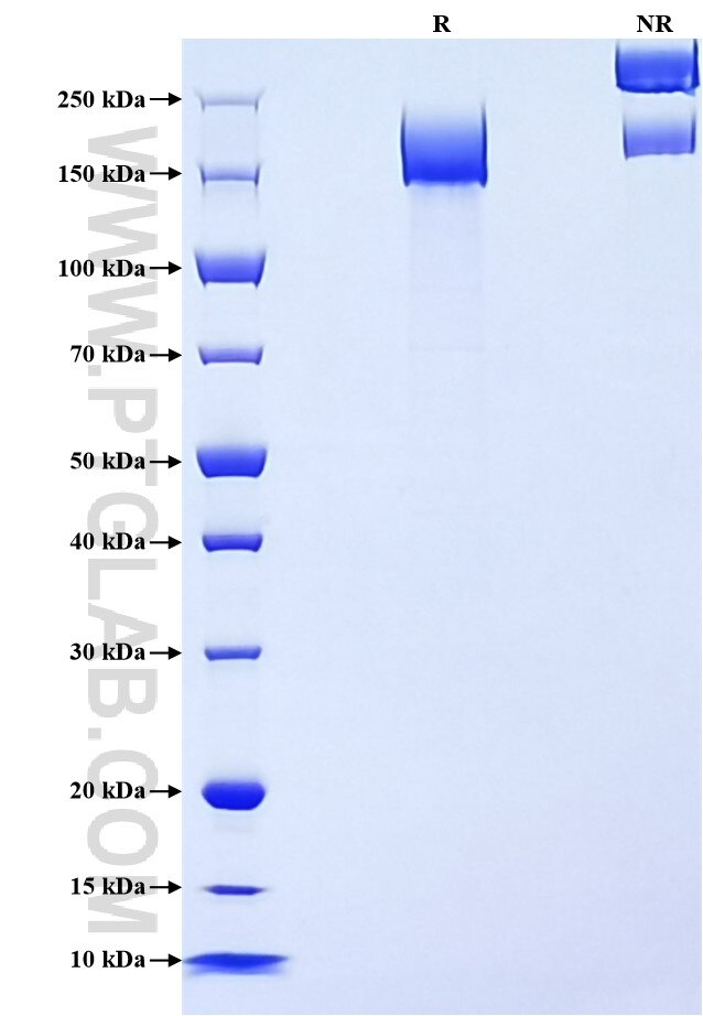 Purity of Recombinant Human MRC2 was determined by SDS-PAGE. The protein was resolved in an SDS-PAGE in reducing (R) and non-reducing (NR) conditions and stained using Coomassie blue.